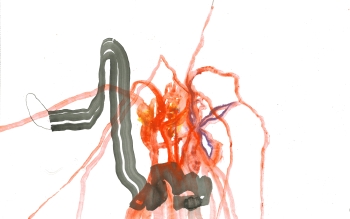 Dessins